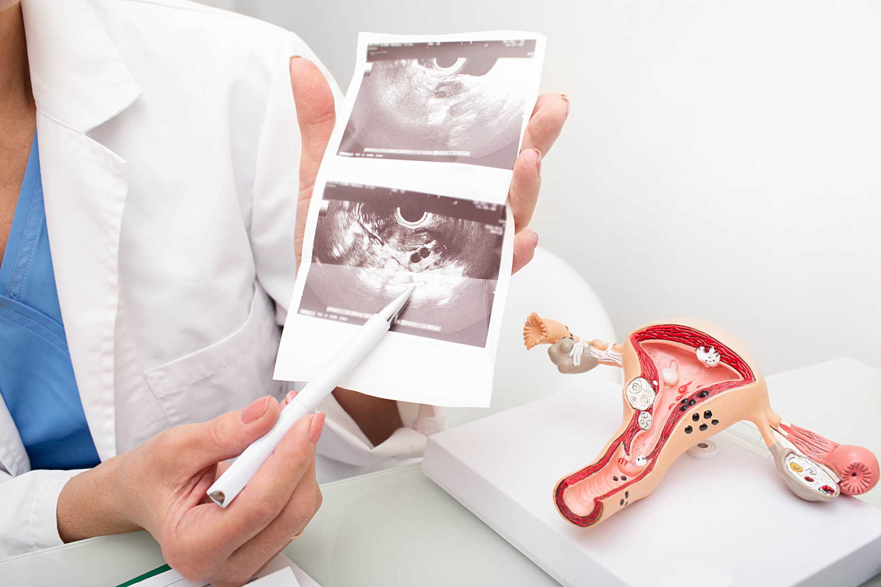 Close-up ultrasound of a ovaries. Female health examination, gynecology